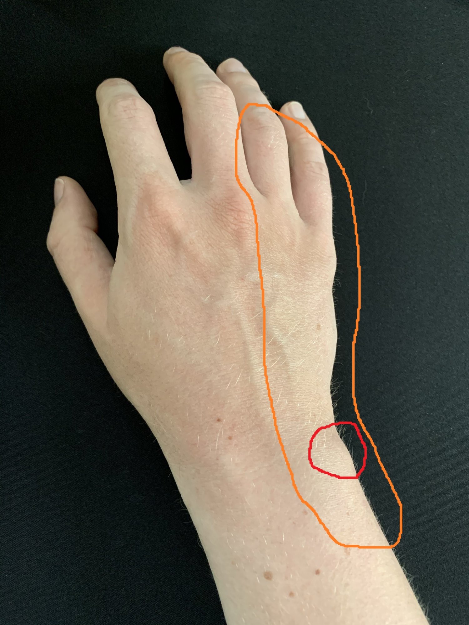 hand-pain-1.jpg